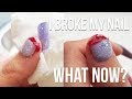 [最も選択された] throbbing pain under fingernail after manicure 224240-What causes throbbing pain under fingernail