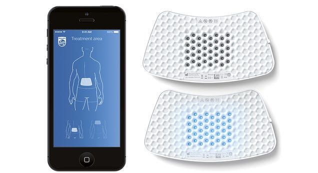 Philips Will Cure Your Aches With Wireless Drug-Free Pain Relievers