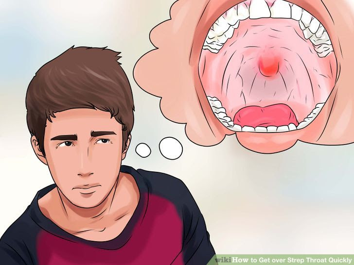 Get over Strep Throat Quickly Step 1.jpg