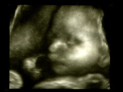 Baby Brother