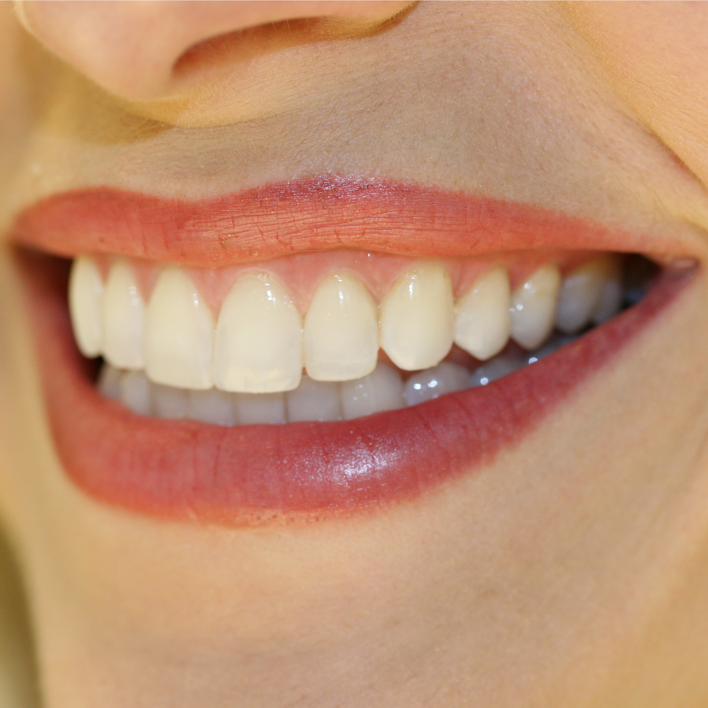 Remarkable Beautiful Teeth Smile 2332 x 2332 · 2863 kB · jpeg