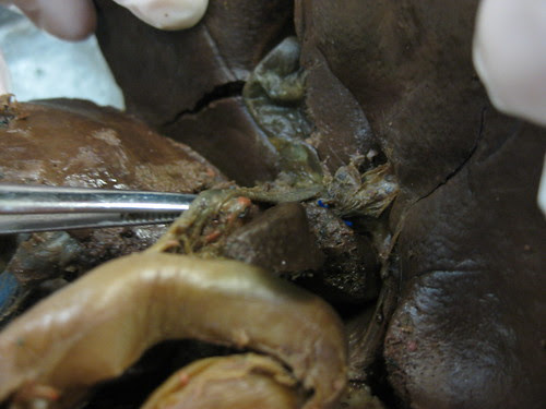 common bile duct diagram. images common bile duct