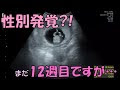 【印刷可能】 妊娠十二週 ���ちゃん 842009