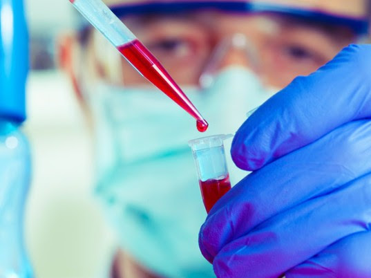 Ebola in the US, US Ebola diagnosis, Ebola, Ebola in America, Ebola, Liberia Ebola, traveler Ebola, Ebola outbreak, Ebola prevention, Ebola spread, Ebola in the US, Ebola in Dallas, Ebola in Texas