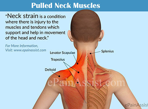 Relieve pulled neck muscle
