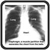 Chset xray