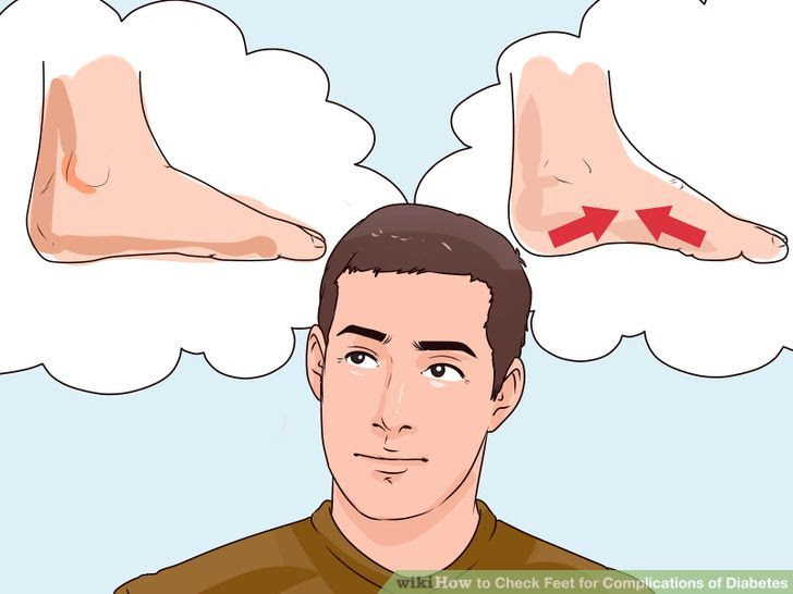 Check Feet for Complications of Diabetes Step 5 Version 2.jpg