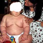 sobrepeso infantil
