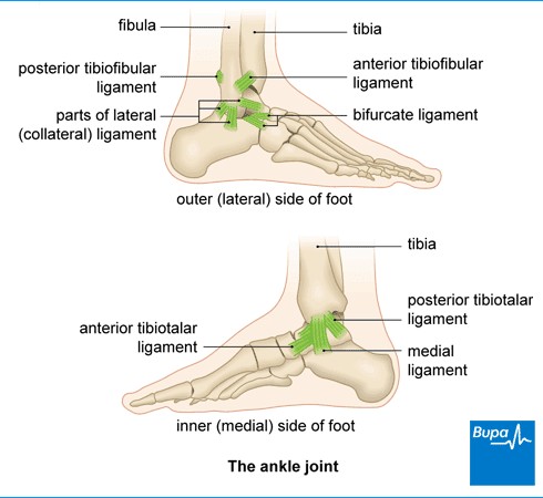 Sprained Ankle Twisted Ankle Symptoms And Treatments Bupa Uk