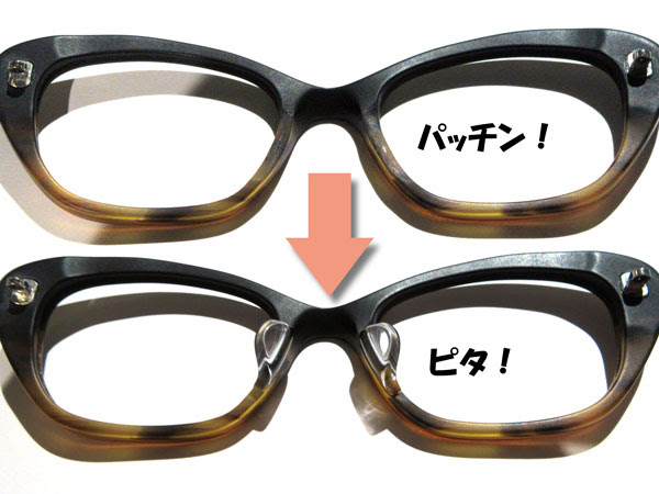 鼻盛り加工 Lunettes Plus
