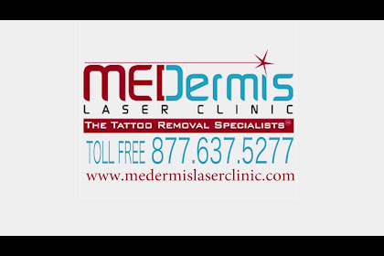medermis tattoo removal austin tx