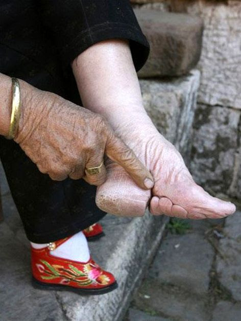 pieds bandes Chinois