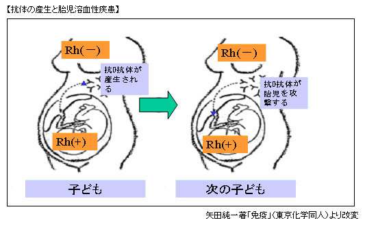免疫グロブリン製剤の適応 一般社団法人日本血液製剤協会