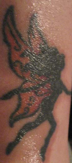 Nuviderm At Home Tattoo Removal: Day One (Second Application) June 30, 2008