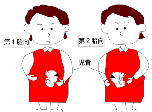 胎位 胎向 胎勢の違い つねぴーblog 内科専攻医