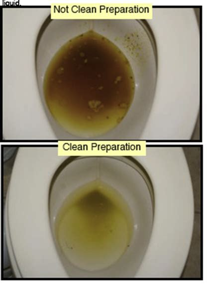  rachel huerta bowel preparation dr temi foster gastroenterologist