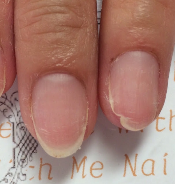爪が割れる原因って With Me Nailでできることや 爪 手の使い方をまとめてみました 高松 屋島 ネイルサロン リノワヤシマ 香川県高松市の 爪を育てるネイルサロン With Me Nail 口コミで40代50代以降の女性に人気の秘密は 爪の形は３ヶ月で自信に変えられる
