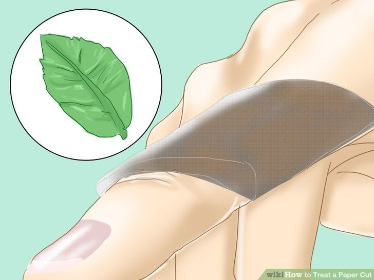 Treat a Paper Cut Step 15.jpg