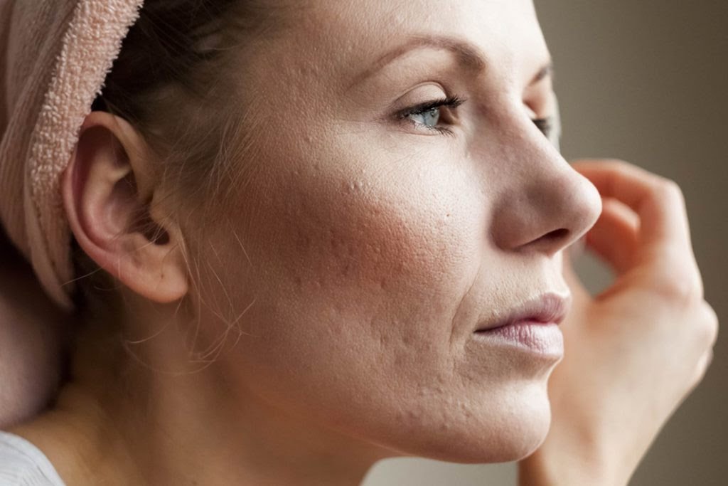 If-You-Have-This-One-Skin-Condition,-You-Could-Be-at-Risk-for-Alzheimer’s_581290531_surowa