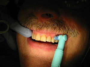 Dental hygienist polishing a patient's teeth