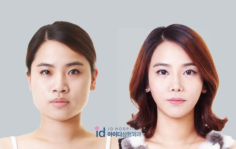 ID美容外科、二重手術、鼻整形、目尻切開
