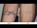 How Can I Remove A Tattoo At Home / 28 Natural Ways on How to Remove Tattoos at Home Fast - page 2 / To start off you should exfoliate the skin by natural scrubbing.