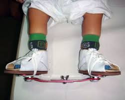 Are You Pigeon Toed? - Almawi Limited The Holistic Clinic