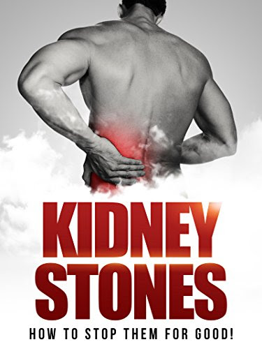 Kidney Stones: Getting Rid of Them for Good! (Kidney Stones Cure, Preventing Kidney Stones), by Chad Gibbs