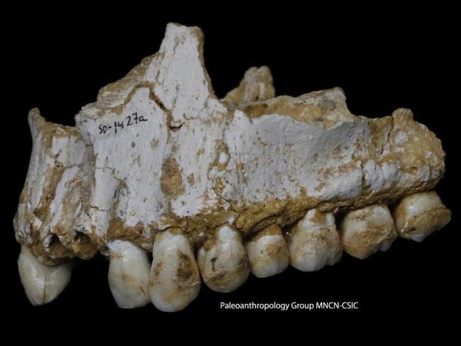 An El Sidron upper jaw: a dental calculus deposit is visible on the rear molar, right, of this Neanderthal. Picture: Paleoanthropology Group MNCN-CSIC / AP