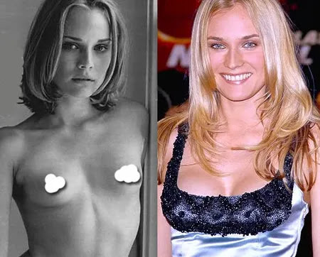 Ketika Operasi Plastik Sukses Membuat Tubuh Lebih Keren!