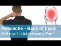 √画像をダウンロード back head headache causes 324930-Back of the head headache causes