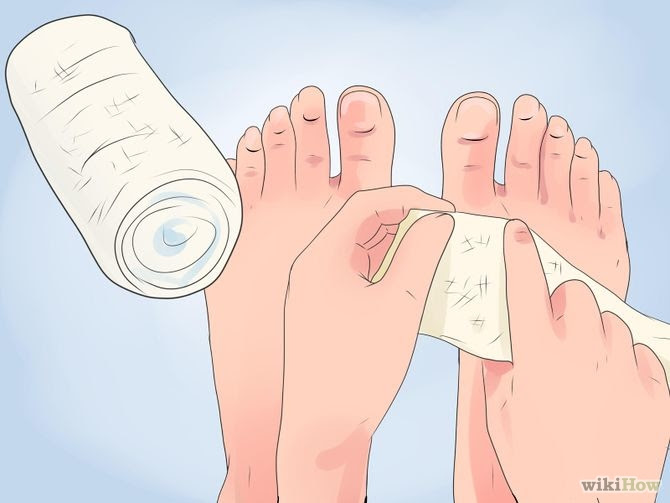 Heal Cracked Skin Step 5 Version 2.jpg