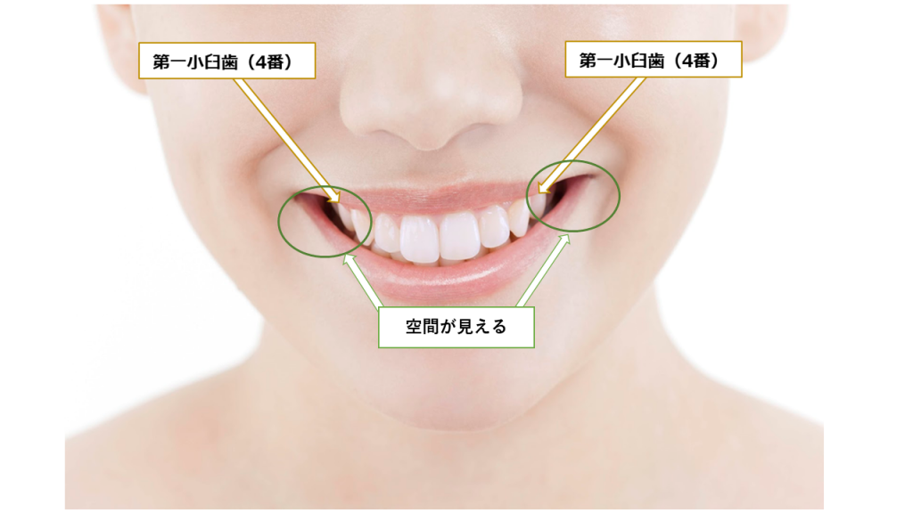 ドクターに聞く歯列矯正 歯列矯正で鼻の下 人中 は伸びる 縮む 葛西モア矯正歯科 葛西駅から徒歩0分 西葛西駅も徒歩圏内 江戸川区の矯正治療専門歯科医院