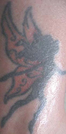 Nuviderm Tattoo Removal Cream: