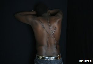 A man described as a Sudanese migrant shows scars on his back in Athens, 5 December 2012