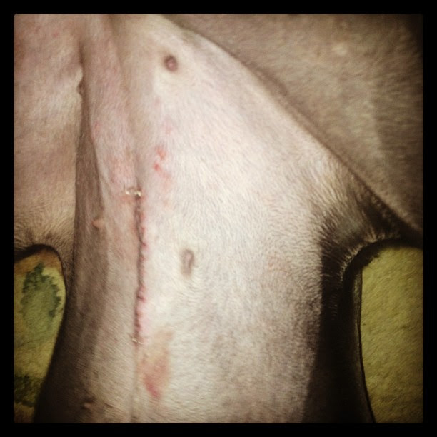#Bronty #Surgery #Scar