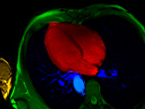 heart image