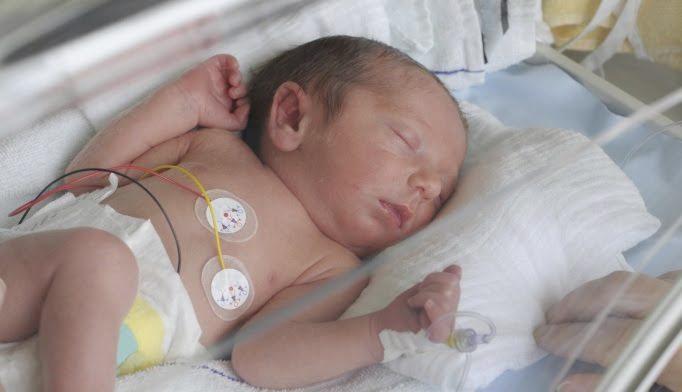 Congenital syphilis rates on the rise, says CDC - The 
