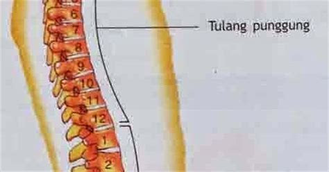 testimoni tulang patah sembuh   sebulan beli