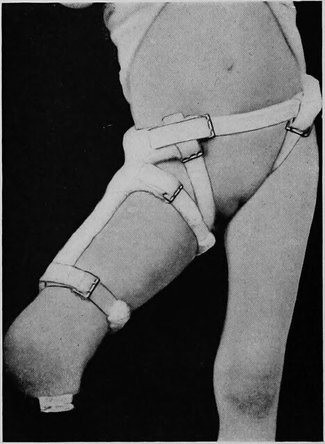 Image from page 133 of Clinical and pathological papers.. (1901)