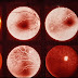 Central Serous Retinopathy Forum / This is due to fluid leaking into your retina, particularly the macula, which is the middle area of the retina responsible for central vision.