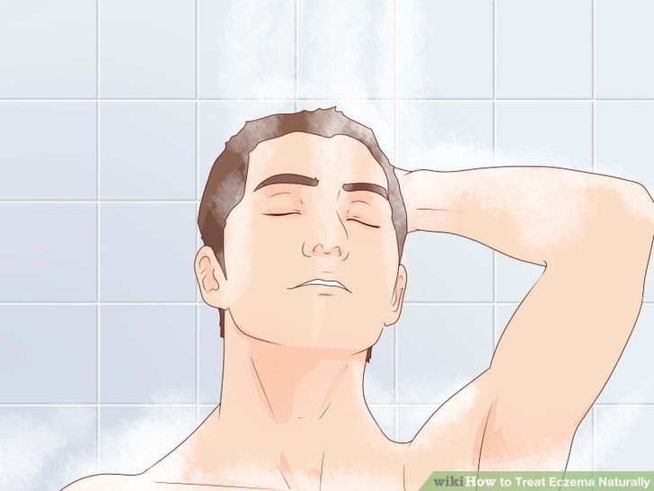 Treat Eczema Naturally Step 7 Version 3.jpg