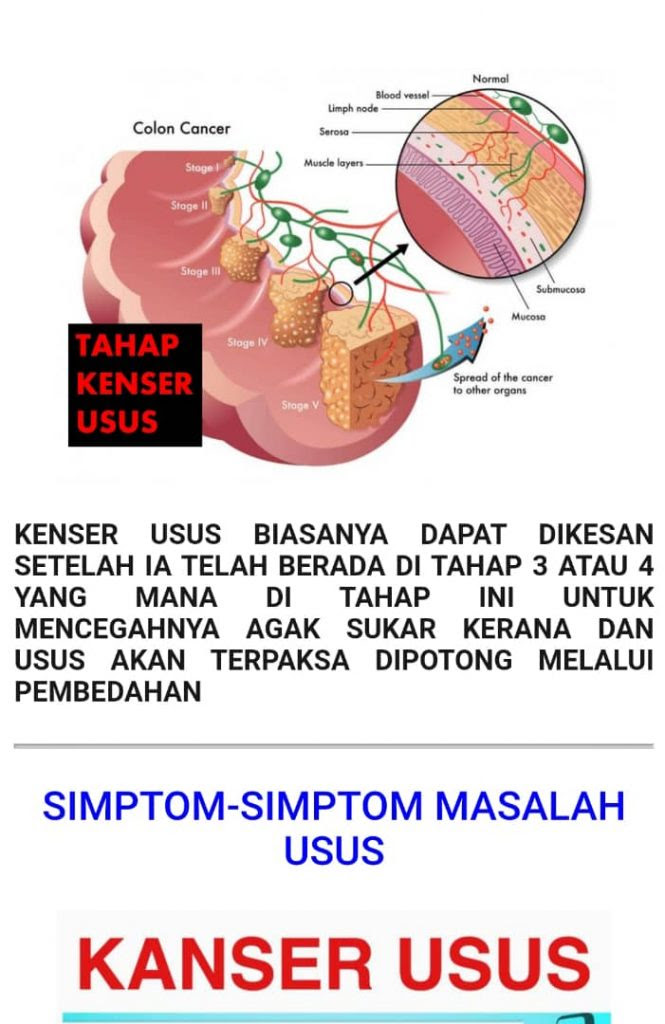 PENYEBAB PENYAKIT u2013 Sihat AG Cera