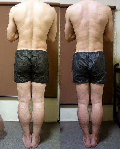 メンズ経絡リンパマッサージ ビフォーアフター 大阪北摂の痩身専門プライベートエステサロンなら高槻市の Regalo レガロ へ