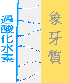 自己責任で行うホワイトニング