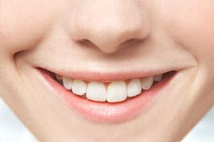 Treat-yellow-teeth-with-these-easy-home-remedies