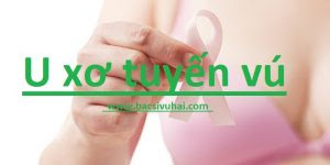 u xơ tuyến vú