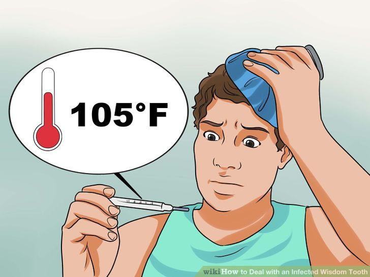 Deal with an Infected Wisdom Tooth Step 1 Version 2.jpg
