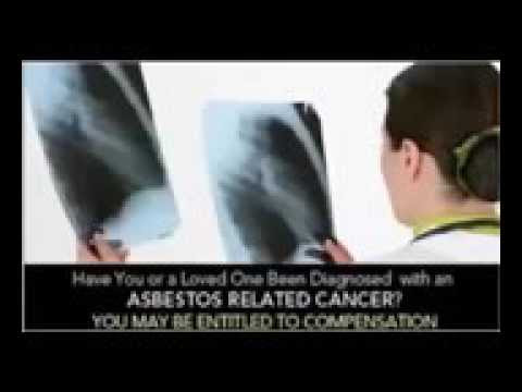 VIDEO : mesothelioma attorney directory lawyers for mesothelioma 3 -  ...