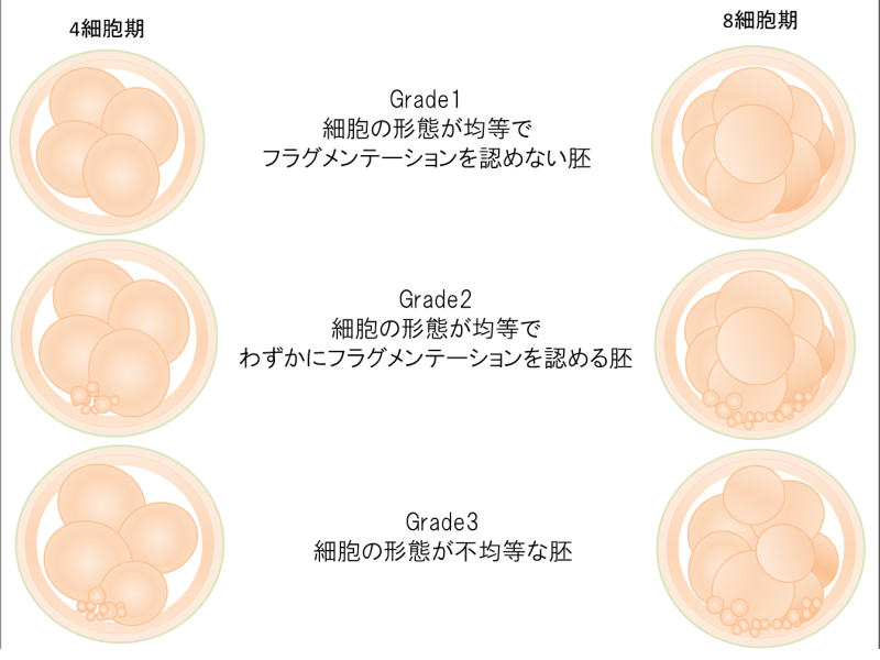 Clinique De L Ange クリニックドゥランジュ 天使のクリニック 妊娠率約5割の高い実績 不妊治療